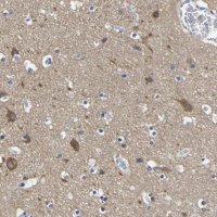 Anti-SLITRK1 antibody produced in rabbit 
