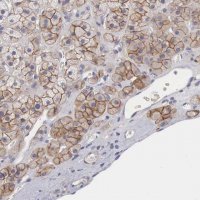 Anti-SLITRK4 antibody produced in rabbit 