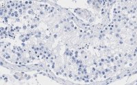 Anti-Smad1 Antibody, clone 1B9 ZooMAb Rabbit Monoclonal 