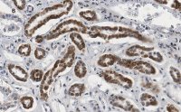 Anti-Smad3 Antibody, clone 1J11, ZooMAb Rabbit Monoclonal 