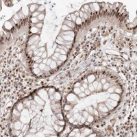 Anti-SMAD7 antibody produced in rabbit 