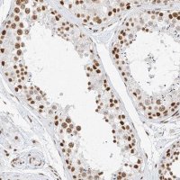 Anti-SMARCA2 antibody produced in rabbit 