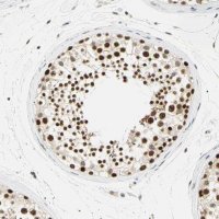 Anti-SMARCA5 antibody produced in rabbit 