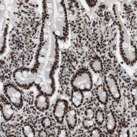 Anti-SMARCB1 antibody produced in rabbit 