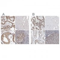 Anti-SMARCC1 antibody produced in rabbit HPA026853-100UL