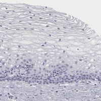 Anti-SMC1B antibody produced in rabbit 