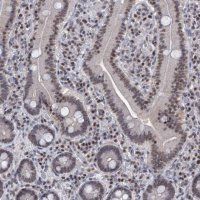 Anti-SMCHD1 antibody produced in rabbit 