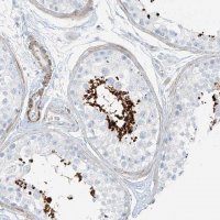 Anti-SMCP antibody produced in rabbit HPA035105-100UL
