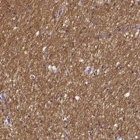 Anti-SMIM17 antibody produced in rabbit 
