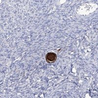 Anti-SMS antibody produced in rabbit 