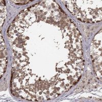 Anti-SMURF2 antibody produced in rabbit 