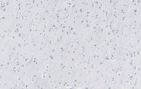 Anti-SNAP-25 Antibody, clone 1J9 ZooMAb Rabbit Monoclonal 