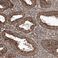 Anti-SNAP47 antibody produced in rabbit 