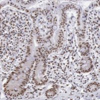 Anti-SNRPD3 antibody produced in rabbit 