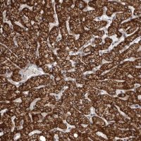Anti-SNX16 antibody produced in rabbit HPA024817-100UL
