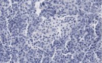 Anti-Somatostatin-28 Antibody, clone 2B19 ZooMAb Rabbit Monoclonal 