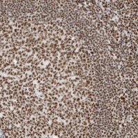 Anti-SON antibody produced in rabbit 