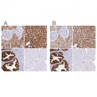 Anti-SORD antibody produced in rabbit HPA040260-100UL