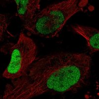 Anti-SOX2 antibody produced in rabbit HPA045725-100UL
