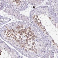 Anti-SPAG1 antibody produced in rabbit 