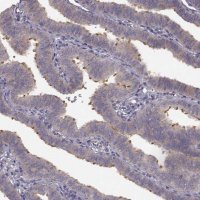 Anti-SPAG17 antibody produced in rabbit 