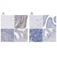 Anti-SPATA18 antibody produced in rabbit 