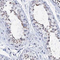 Anti-SPATA19 antibody produced in rabbit 