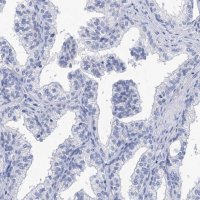 Anti-SPATA7 antibody produced in rabbit 