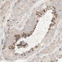 Anti-SPATA9 antibody produced in rabbit 