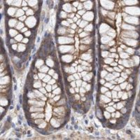 Anti-SPECC1 antibody produced in rabbit 