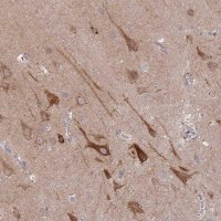 Anti-SPHKAP antibody produced in rabbit 