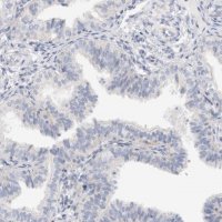 Anti-SPINK2 antibody produced in rabbit 