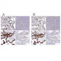 Anti-SPNS1 antibody produced in rabbit 