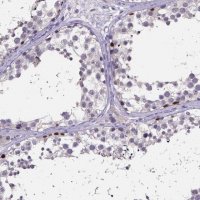Anti-SPOCD1 antibody produced in rabbit 