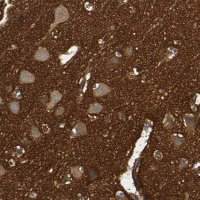 Anti-SPTAN1 antibody produced in rabbit 