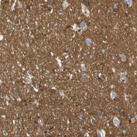 Anti-SPTBN1 antibody produced in rabbit 