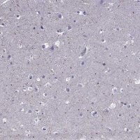 Anti-SPTBN4 antibody produced in rabbit 