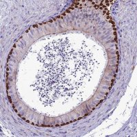Anti-SPTLC3 antibody produced in rabbit 