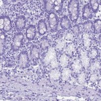 Anti-STATH antibody produced in rabbit 