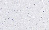 Anti-Stathmin-2 Antibody, clone 1B3 ZooMAb Rabbit Monoclonal 