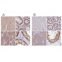 Anti-STIP1 antibody produced in rabbit 