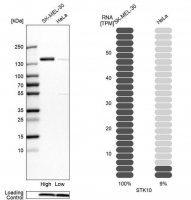 Anti-STK10 antibody produced in rabbit HPA015083-100UL