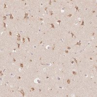 Anti-STK39 antibody produced in rabbit 