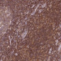 Anti-STK4 antibody produced in rabbit 