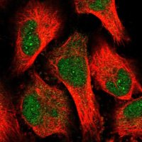 Anti-STN1 antibody produced in rabbit HPA037924-100UL