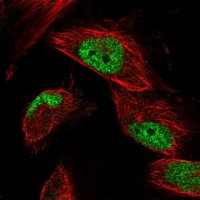 Anti-STN1 antibody produced in rabbit HPA037925-100UL