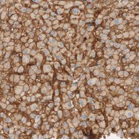 Anti-STOM antibody produced in rabbit HPA010961-100UL