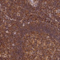 Anti-STOML1 antibody produced in rabbit 