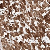 Anti-STX19 antibody produced in rabbit 