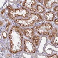 Anti-STX7 antibody produced in rabbit 